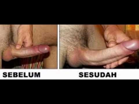 081328887815 Jual Obat Pembesar Penis Di Brunei | Agen Vimax Pills Pin 2637