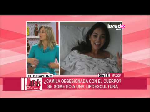 Camila Recabarren habla de su nueva cirugÃ­a estÃ©tica