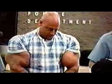 The Man Whose Arms Exploded Part 3