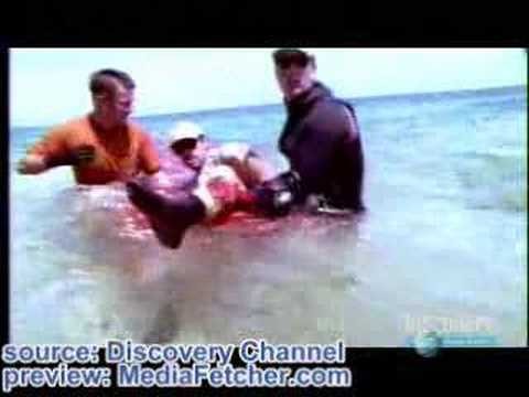 Tiburon ataca a un humano y le come la pierna