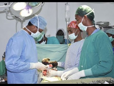 Eritrea - Surgeons Remove a 1kg Hair-Ball from a 20 year Old Girl