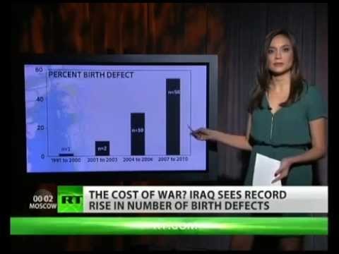 Birth defects skyrocket in Iraq after US invasion