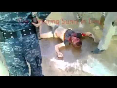 Iraqi Shiite Extremists Attack And Burn A Sunni Called Omar - Same In Syria