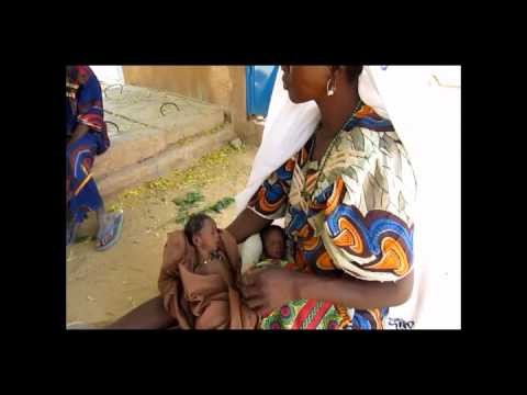 Food crisis in Niger, Nov 11: Faces of hunger - the Chadakori twins