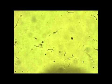 Spit Sample Day 12 - Morgellons !