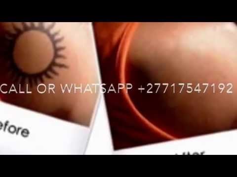 TATTOO REMOVAL CREAM OR GEL CALL +27717547192 South Africa Durban'johannesb